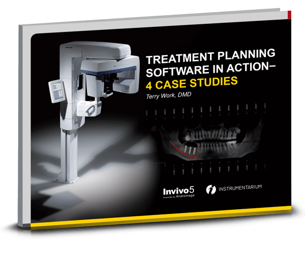 Treatment Planning Software In Action - 5 Case Studies